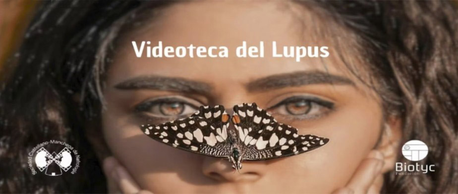 Videoteca de Lupus